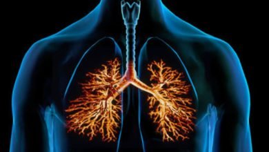 التهاب الشعب الهوائية