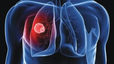 انتشار فيروس كورونا